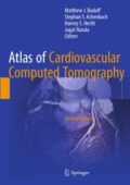 img Atlas of Cardiovascular Computed Tomography By Matthew J. Budoff (2018) - ENG