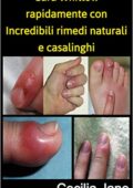 img Cecilia Jane - Cura Whitlow rapidamente con Incredibili rimedi naturali e casalinghi (2020)