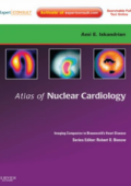 img Atlas of Nuclear Cardiology: Imaging Companion to Braunwald