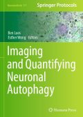 Imaging and Quantifying Neuronal Autophagy - Ben Loos (Editor)