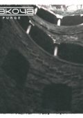 Sakoya - II Purge (2024)